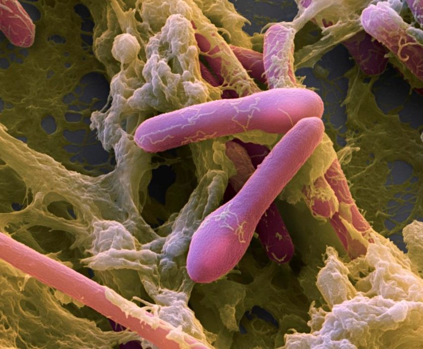 La bactérie tueuse Clostridium botulinum. Photo : Cedric Woudstra, Universiy of Copenhagen – Food Safety and Zoonoses