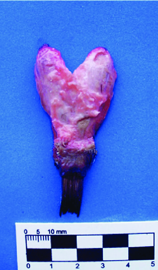 Macroscopique image de la glande uropygienne du manchot papou ((Pygoscelis papua), in María Cecilia Chiale & Alii « Morphology and histology of the uropygial gland in Antarctic birds: Relationship with their contact with the aquatic environment? », Australian Journal of Zoology, 62(2), avril 2014